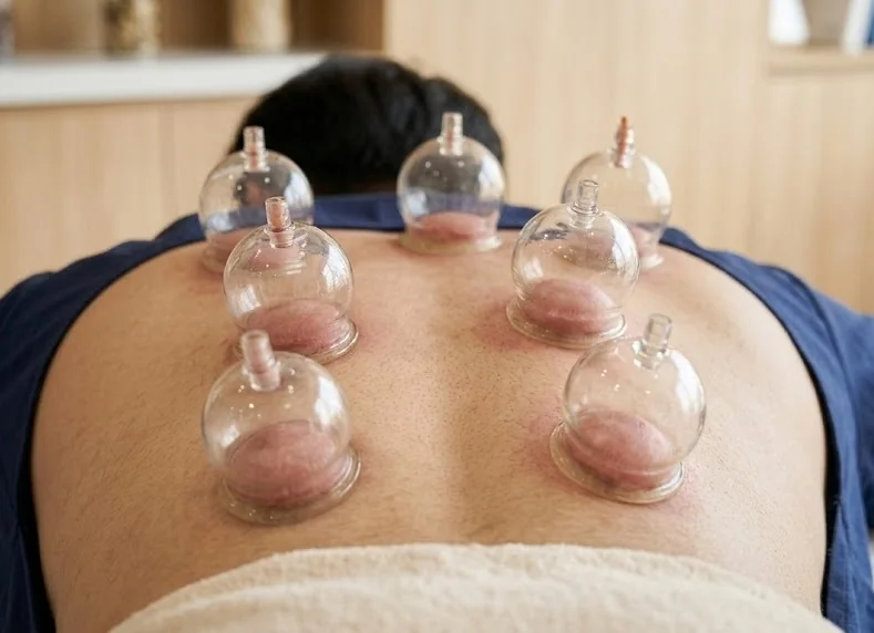 물리치료 · 침치료 · 부항치료 사진